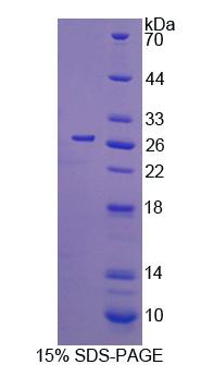 RPE614Hu01.jpg