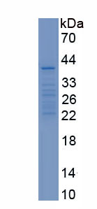 Recombinant Cell Division Cycle Protein 73 (CDC73)