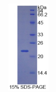 Recombinant Cyclin Dependent Kinase Inhibitor 1A (CDKN1A)