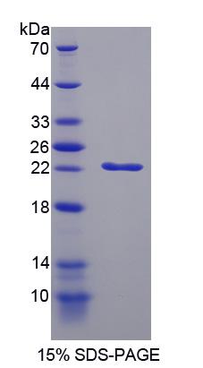 Recombinant Cyclin Dependent Kinase Inhibitor 1A (CDKN1A)