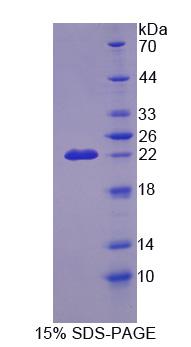 Recombinant Cyclin Dependent Kinase Inhibitor 2D (CDKN2D)