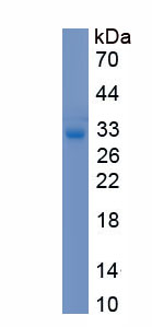 RPE634Hu01.jpg