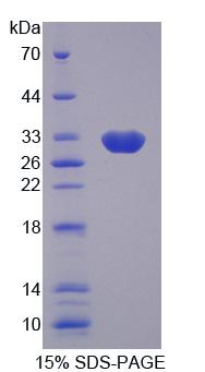 Recombinant Guanylate Binding Protein 2, Interferon Inducible (GBP2)