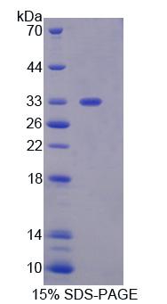 Recombinant Guanylate Binding Protein 2, Interferon Inducible (GBP2)