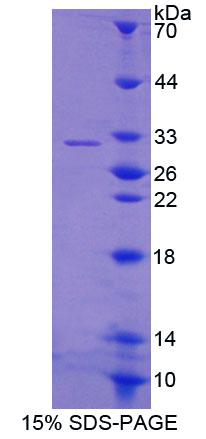 Recombinant Guanylate Binding Protein 2, Interferon Inducible (GBP2)