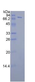 Recombinant FK506 Binding Protein 5 (FKBP5)