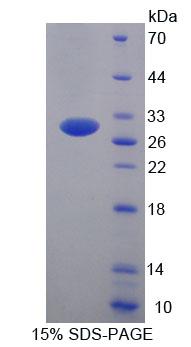 Recombinant Ubiquitin Conjugating Enzyme E2S (UBE2S)