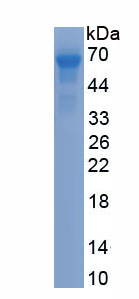 Recombinant Collapsin Response Mediator Protein 5 (CRMP5)