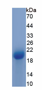 Recombinant Regenerating Islet Derived Protein 1 Beta (REG1b)