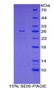 Recombinant FK506 Binding Protein 8 (FKBP8)