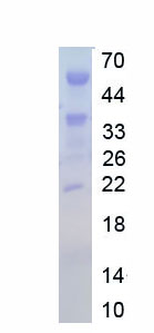 Recombinant N-Acylsphingosine Amidohydrolase 2 (ASAH2)