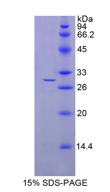 Recombinant N-Acylethanolamine Acid Amidase (NAAA)