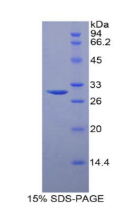 Recombinant Sphingosine Kinase 1 (SPHK1)