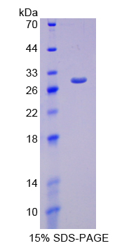 Recombinant Inhibitory Subunit Of NF Kappa B Epsilon (IkBe)