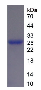 Recombinant Tubulin Beta 1 (TUBb1)