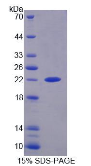 Recombinant Excision Repair Cross Complementing Rodent Repair Deficiency Complementation 6 (ERCC6)