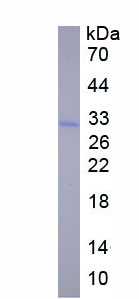 Recombinant Excision Repair Cross Complementing Rodent Repair Deficiency Complementation 6 (ERCC6)