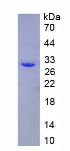 Recombinant Karyopherin Alpha 1 (KPNa1)