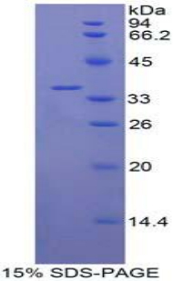 Recombinant Interleukin 22 Receptor (IL22R)