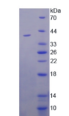 Recombinant Interleukin 22 Receptor (IL22R)