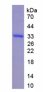 Recombinant Interleukin 22 Receptor (IL22R)