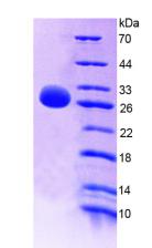 Recombinant Interleukin 22 Receptor Alpha 2 (IL22Ra2)