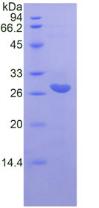 Recombinant Interleukin 22 Receptor Alpha 2 (IL22Ra2)