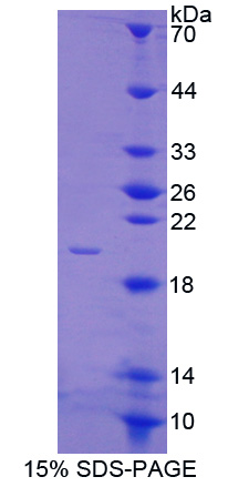 Recombinant Annexin A4 (ANXA4)