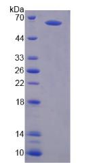 Recombinant Glutamate Receptor, Ionotropic, N-Methyl-D-Aspartate 2A (GRIN2A)