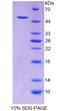 Recombinant Aldehyde Dehydrogenase 1 Family, Member A2 (ALDH1A2)