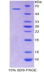 Recombinant Aldehyde Dehydrogenase 7 Family, Member A1 (ALDH7A1)