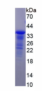 Recombinant Aldehyde Dehydrogenase 7 Family, Member A1 (ALDH7A1)