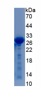 Recombinant Inositol-1,4,5-Trisphosphate Receptor Type 1 (ITPR1)