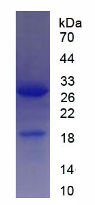 Recombinant Sirtuin 1 (SIRT1)