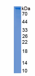 Recombinant Sirtuin 1 (SIRT1)
