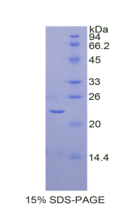 Recombinant Sirtuin 3 (SIRT3)