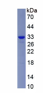 Recombinant Sirtuin 5 (SIRT5)