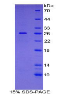 Recombinant Filamin C Gamma (FLNC)