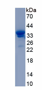 Recombinant Eukaryotic Translation Initiation Factor 4A1 (EIF4A1)