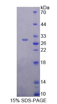 Recombinant Eukaryotic Translation Initiation Factor 4H (EIF4H)