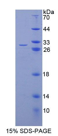 Recombinant Eukaryotic Translation Elongation Factor 1 Alpha 1 (EEF1a1)