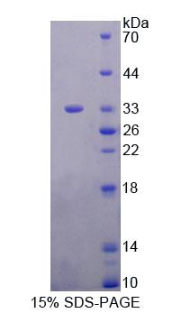 Recombinant Eukaryotic Translation Elongation Factor 1 Beta 2 (EEF1b2)