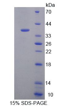 Recombinant Eukaryotic Translation Elongation Factor 1 Delta (EEF1d)