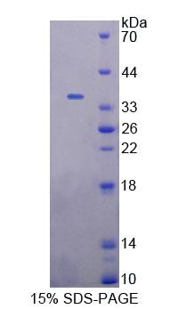 Recombinant Eukaryotic Translation Elongation Factor 1 Delta (EEF1d)