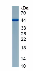 Recombinant Ribosomal Protein L6 (RPL6)