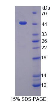 Recombinant G Protein Alpha 11 (GNa11)
