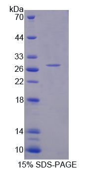 Recombinant Replication Factor C5 (RFC5)
