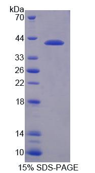 Recombinant Nuclear Receptor Corepressor 1 (NCOR1)