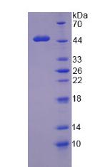 Recombinant Wilms Tumor Protein (WT1)