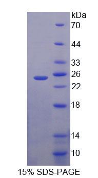 Recombinant Exportin 5 (XPO5)